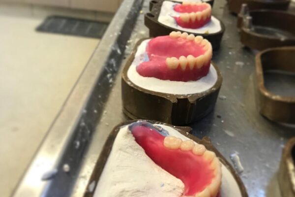 denture alignment