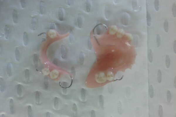 custom partial dentures