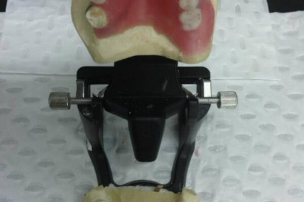 full denture