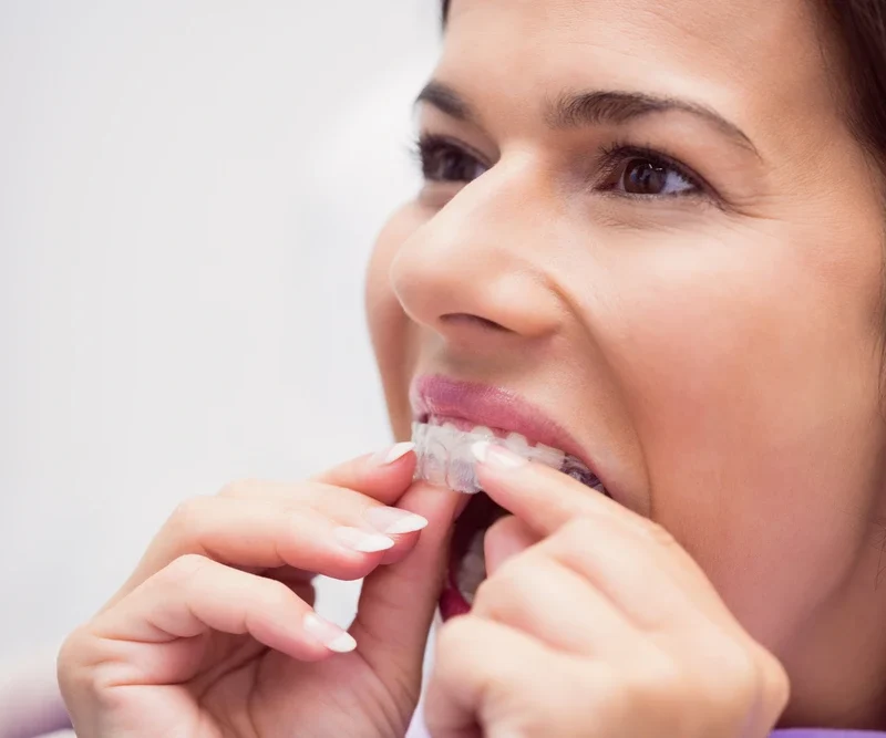 Sleep Guard for Teeth