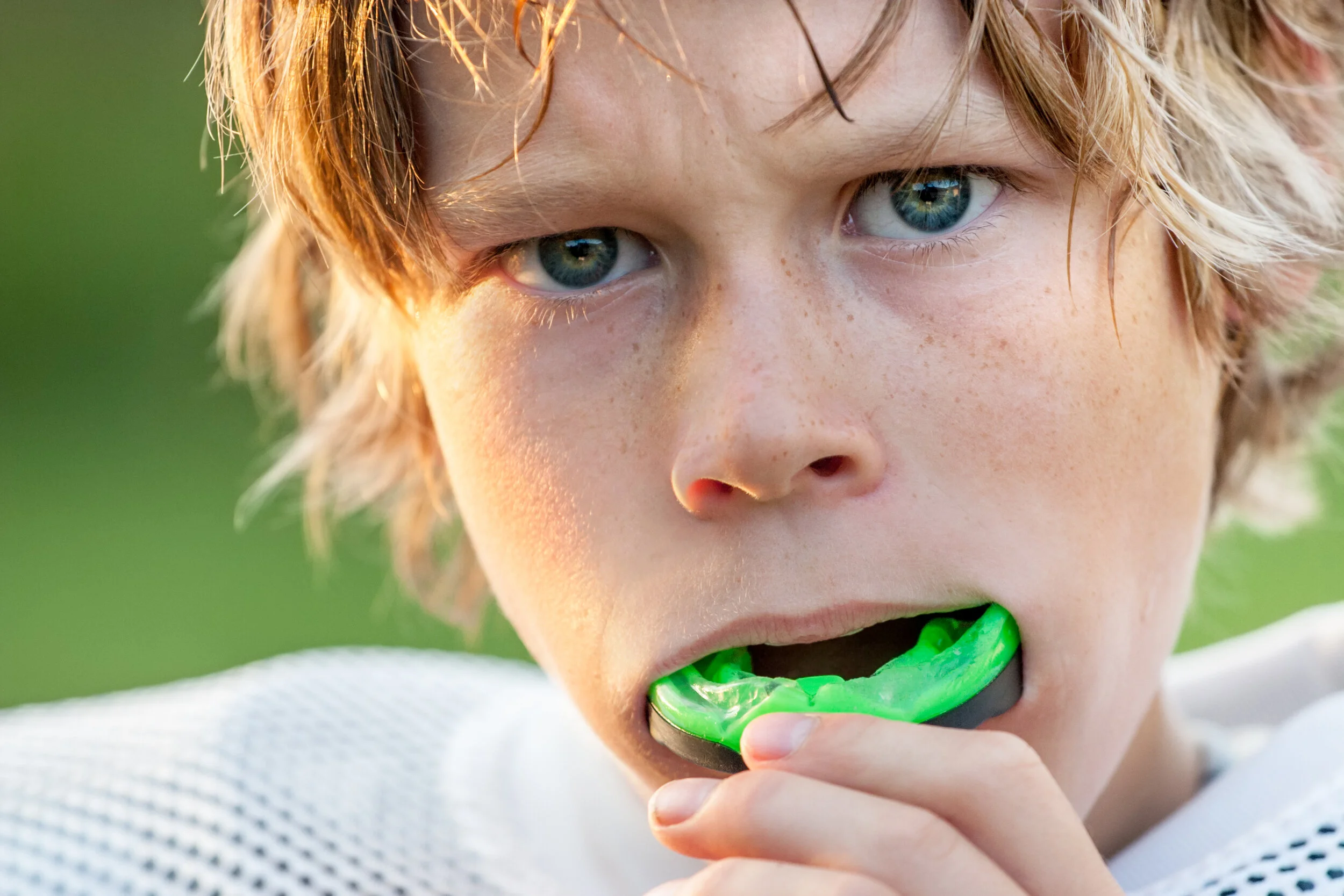 Best Sports Mouthguards for Kids With Braces: Ipswich Parent Guide